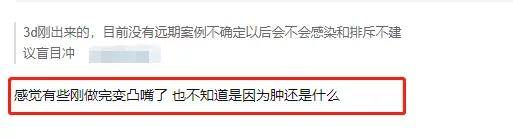 地基100个鼻基底塌陷的人，99个都想做3D打印鼻基底