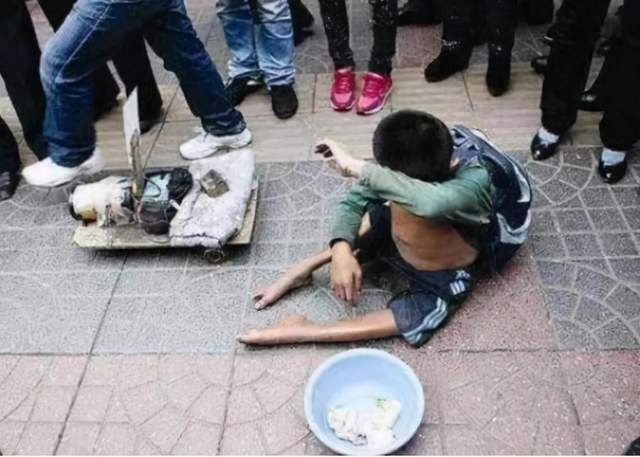 那些畸形乞丐真的是天生残疾吗看看人类到底有多残忍