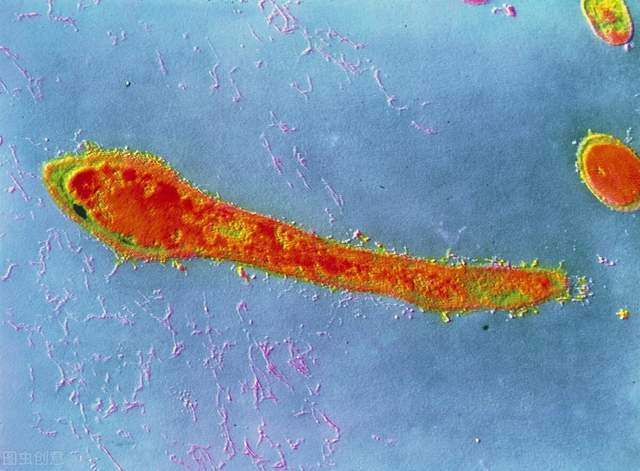 都可|肛周脓肿的原因