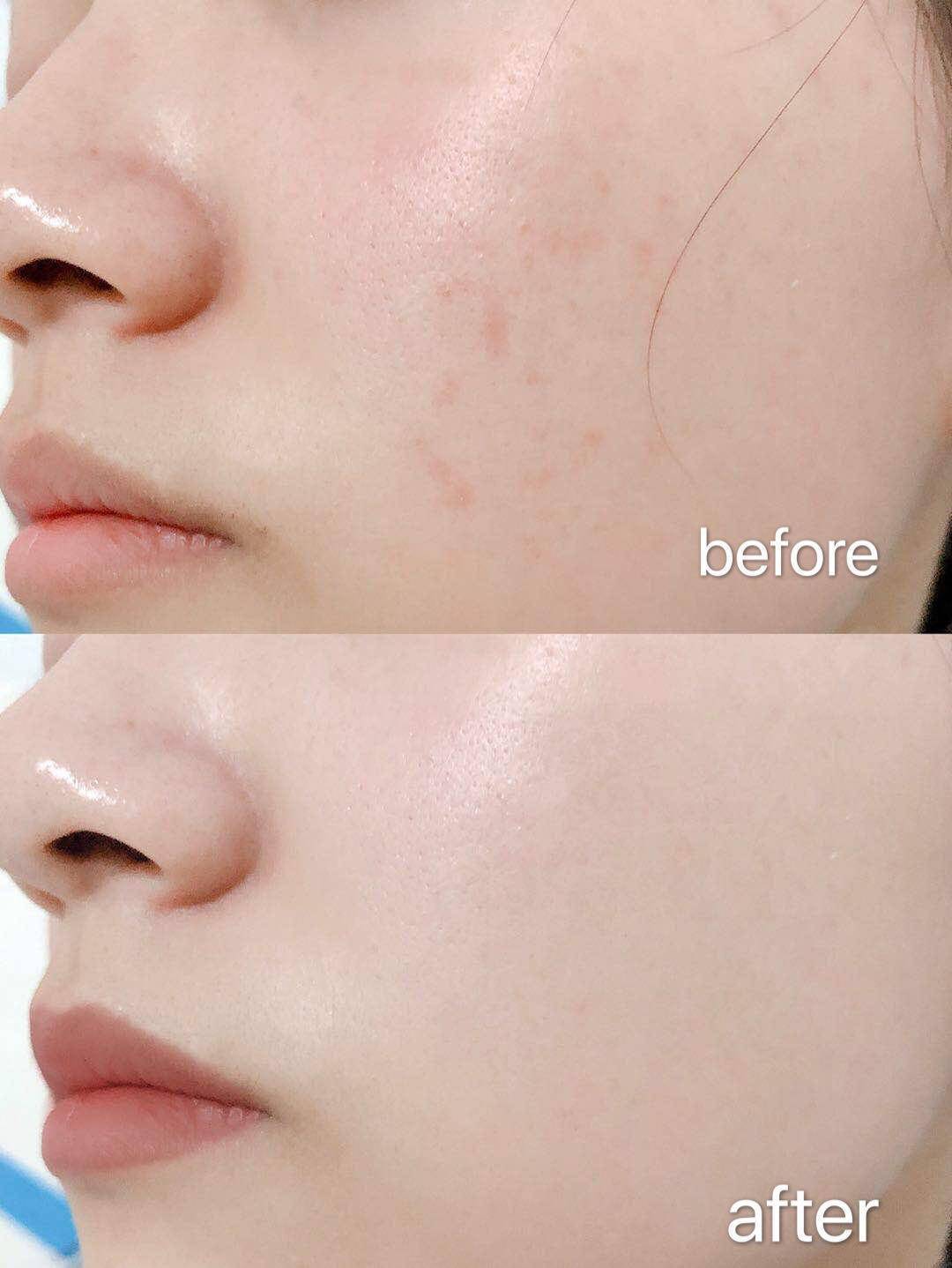 急救模特们的拍摄前脸蛋急救,这个方法秋冬也太实用了吧!