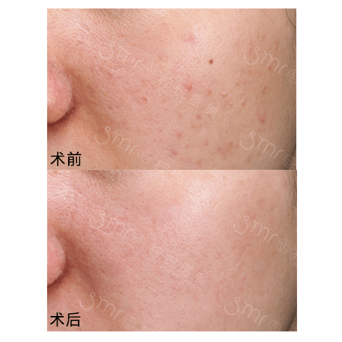 症状不做轻医美很惨,做了轻医美更惨?