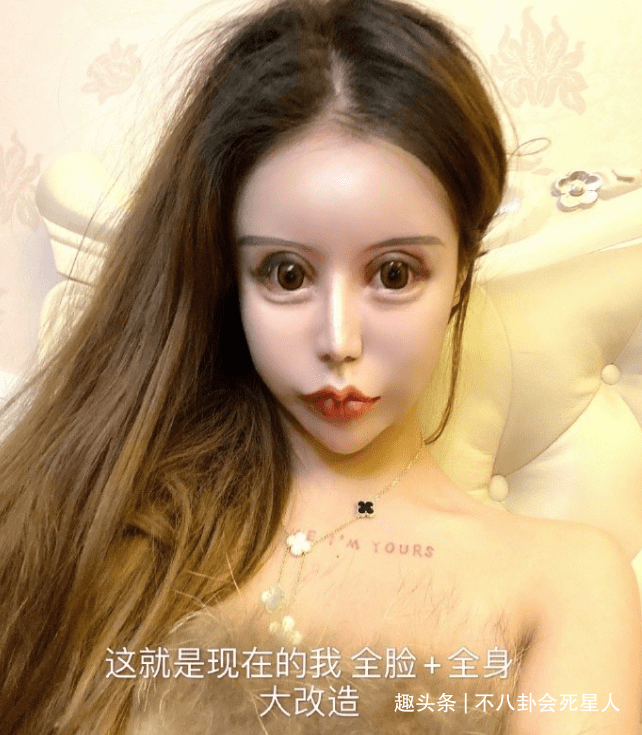 因为00后网红整容成瘾，13岁开整花费百万，整成惊悚脸想选秀出道