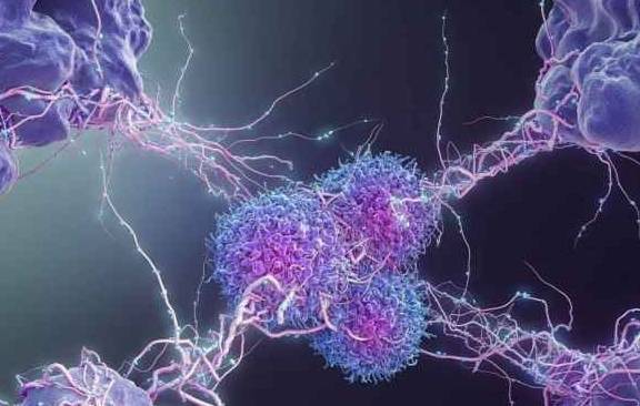 膀胱|不论男女，超过50岁，这13种疾病可能在“偷偷摸摸”靠近你！