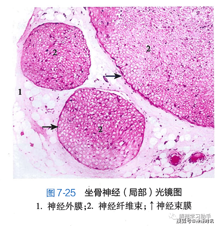 (1)躯体运动神经末梢(又称运动终板,分布于骨骼肌.