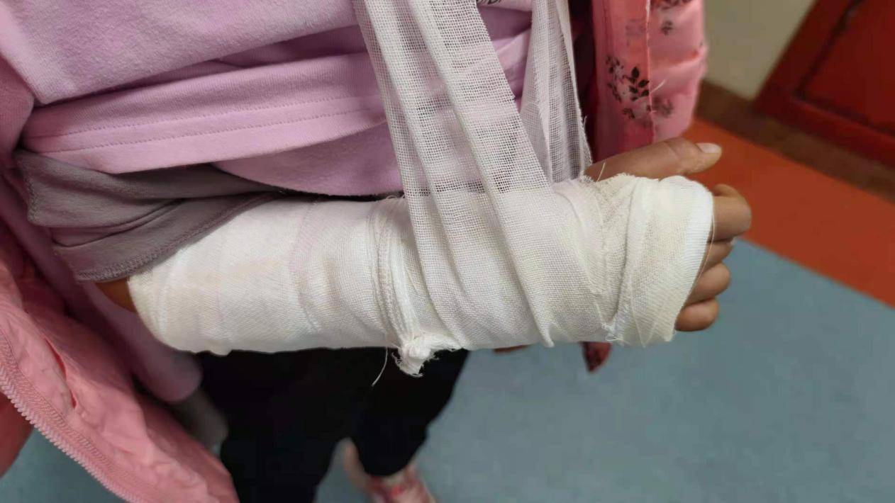 怎么看小孩有没有骨折 961245e52b344fa19dbf2a85fcd009c6.jpeg