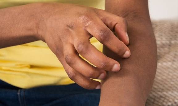 说出来你可能不信，患上糖尿病的第1个症状，或出现在你的皮肤上_患者_ 