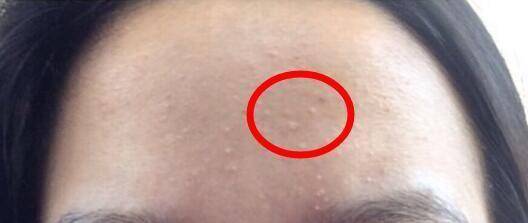 眼睛|肝脏的解毒功能会表现在脸上?你若没有4种情况,肝脏很健康