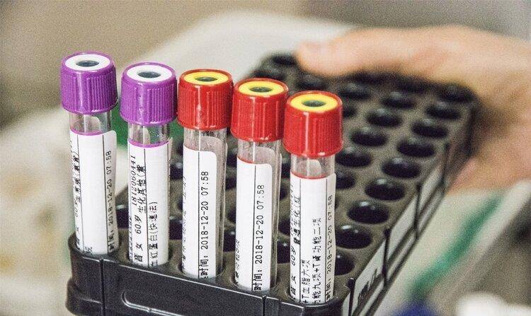 饮食|5大伤肾行为，导致肾病频发！别不当回事，小心以后摊上大事