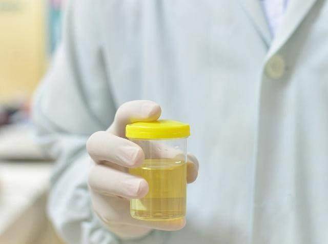 毒素|40岁后，这7个表现，若占3个以上，说明你肝脏还不错哦