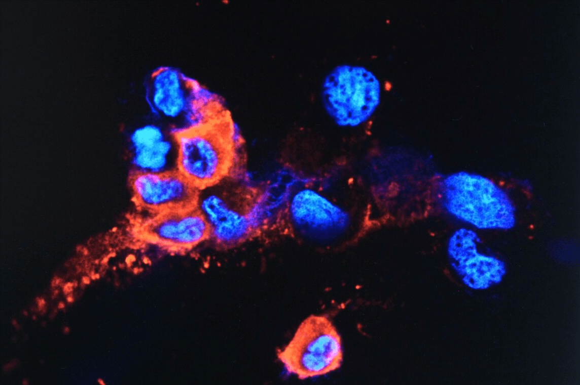 病毒|变异毒株奥密克戎来势汹汹，疫苗加强针还有用吗？专家说出实情