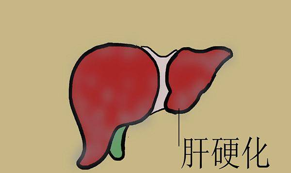 面包|27岁小伙子腹泻不止，查出肝硬化，医生告诫：2种早餐应少碰