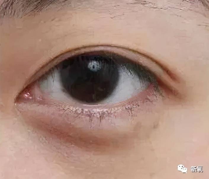 结构型看了印度选美冠军的素颜,我裂开了…