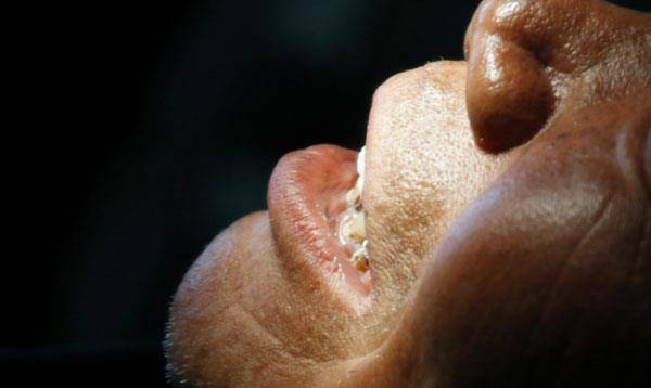 血液|从乙肝发展到肝癌，大约要10年？医生：别有侥幸心理，尽早预防