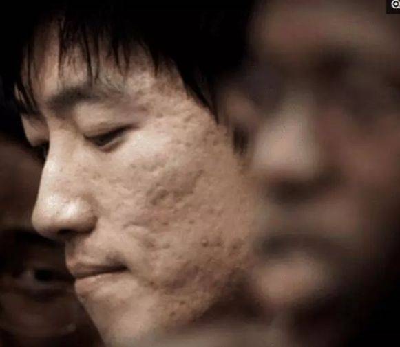 青春痘男明星其实也会“卸妆死”，王俊凯令人大跌眼镜，最后这颜值服了