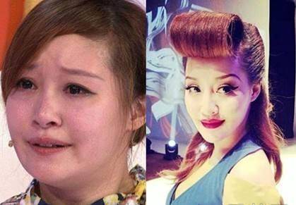 下巴明星的N种“假下巴”，尖到戳死人，翘成老巫婆，一个比一个怪异
