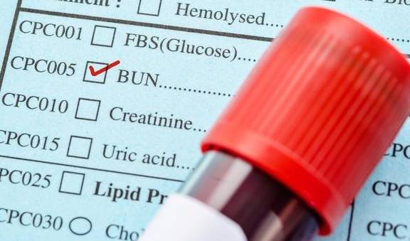 球蛋白|关于肾功能,体检化验单上的这些参考值,你读懂了吗?