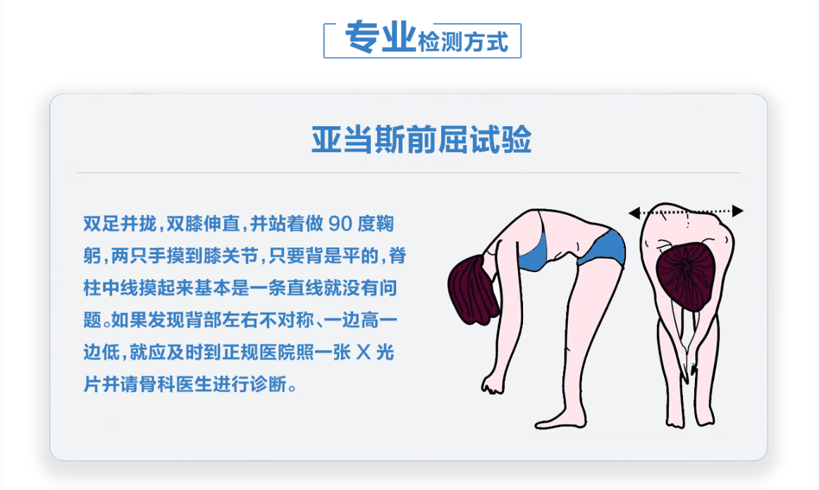 如何判断孩子有没有脊柱侧弯