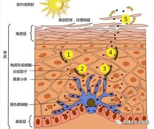 讲堂库博士祛痘小讲堂 | 我们脸上为什么会长斑？