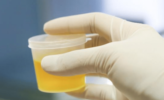 毒素|肝胆医生提醒:肝不好,晨起会有4种表现,若一个不占,肝还健康