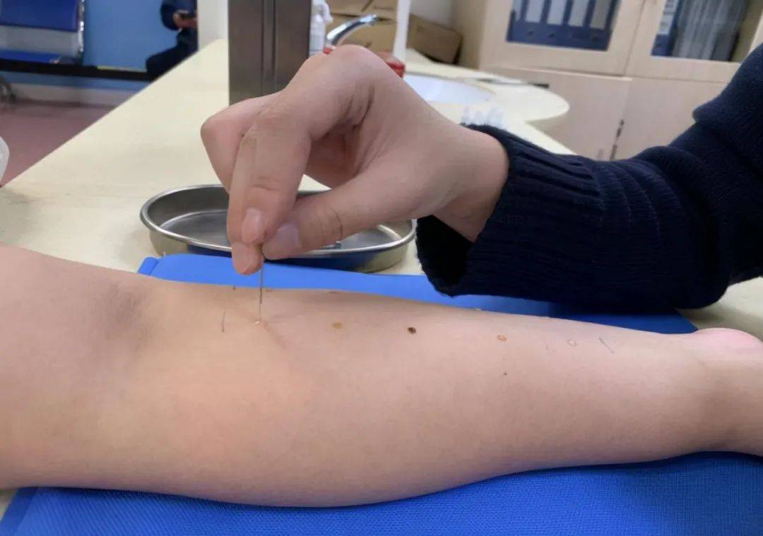 试验_患者_试液