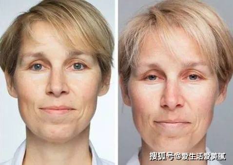 严重嘉宜老师小课堂|：这些陋习，让你变丑的速度超过99%的同龄人！