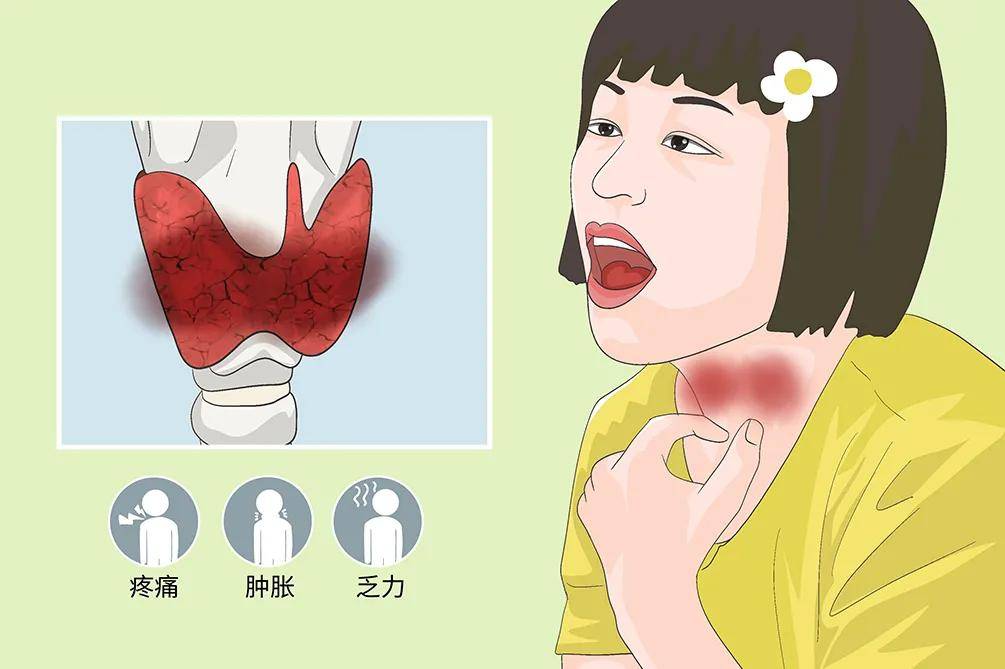 甲状腺炎可分为3大类:急性化脓性甲状腺炎,亚急性肉芽肿性甲状腺炎