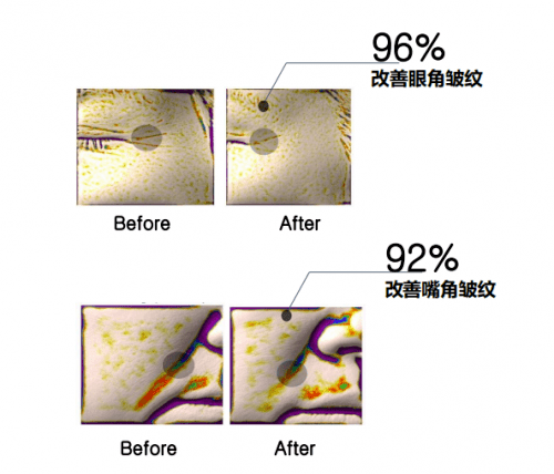 needly尖端工业设备+全新护肤理念，韩国妮德丽护肤不走寻常路