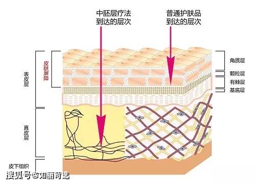 瑞蓝花几万块打水光惨遭毁容?真假水光，没搞明白前劝你别去踩雷......