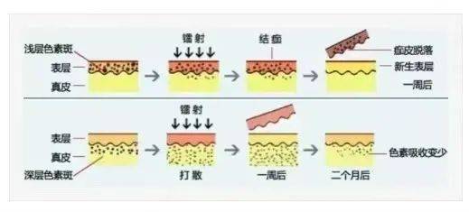 来例假打水光针怎么办