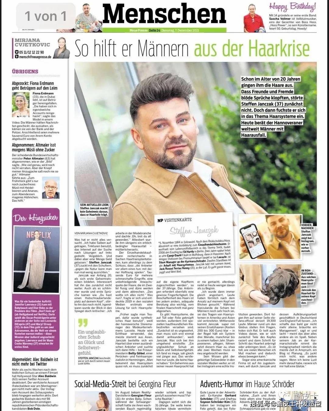 斯蒂芬·扬扎克20岁秃顶，如今却是有上万粉丝的时尚达人！前后反差完全不输楚淇