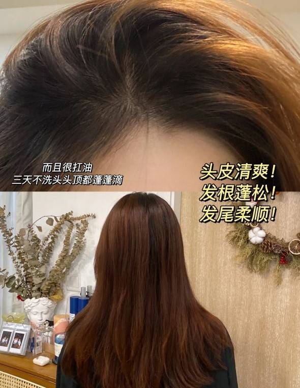 头皮秃头、油田星人警告！热门孕期洗发水雷品盘点，你洗发水合格吗？