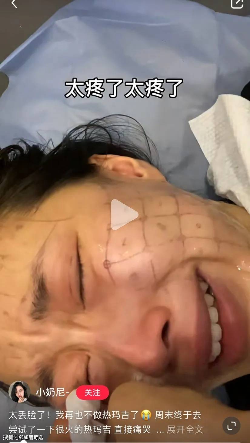 玛吉明星都在做的热玛吉？不推荐你做，理由只有一个（不是贵）