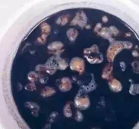 吃啥能软化血管降血压 294c82aa02334c37be35667c4a29a950.jpeg