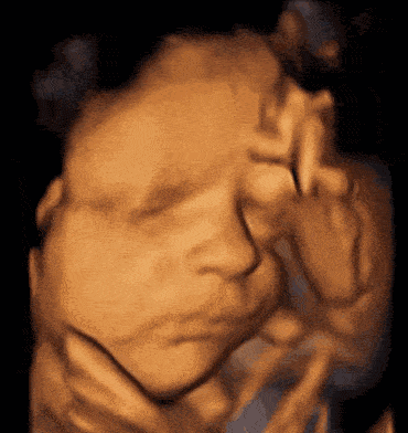 bfe3d9e48c674141b7b9fcff18319069.gif