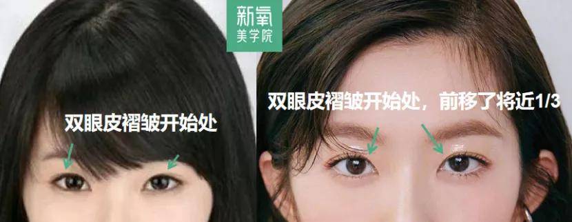 度数很多人都混淆了眯眯眼和小眼睛的区别