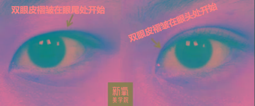 度数很多人都混淆了眯眯眼和小眼睛的区别