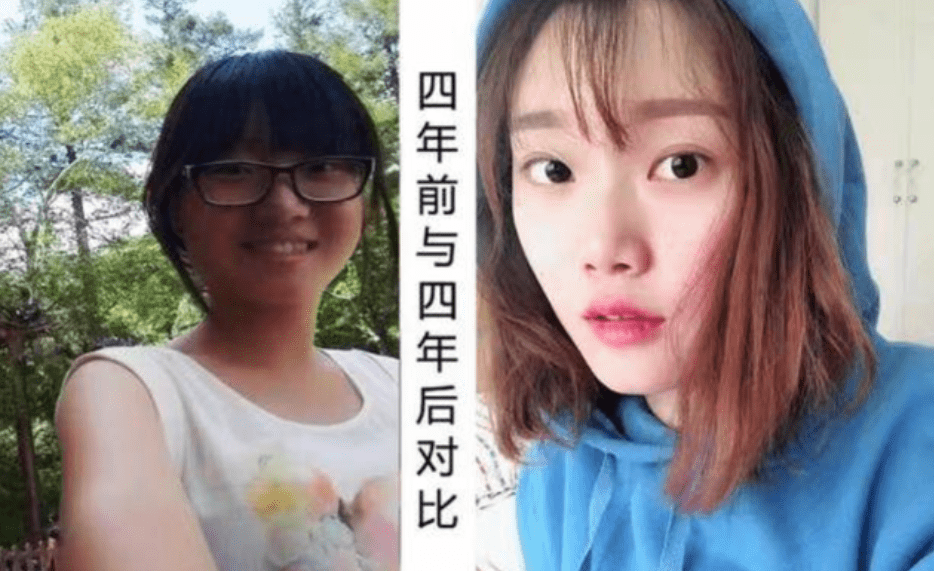 比较长的揪痧 944038aeebc74f018358a7620c36c2e0.png