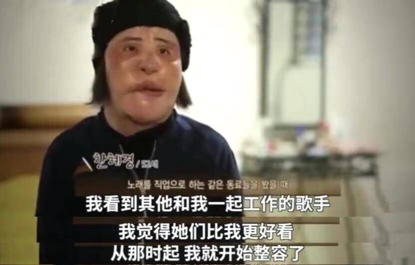 因为10位整容毁掉的女星：有人自己注射食用油，有人上瘾，有人丢了命