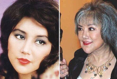 因为10位整容毁掉的女星：有人自己注射食用油，有人上瘾，有人丢了命