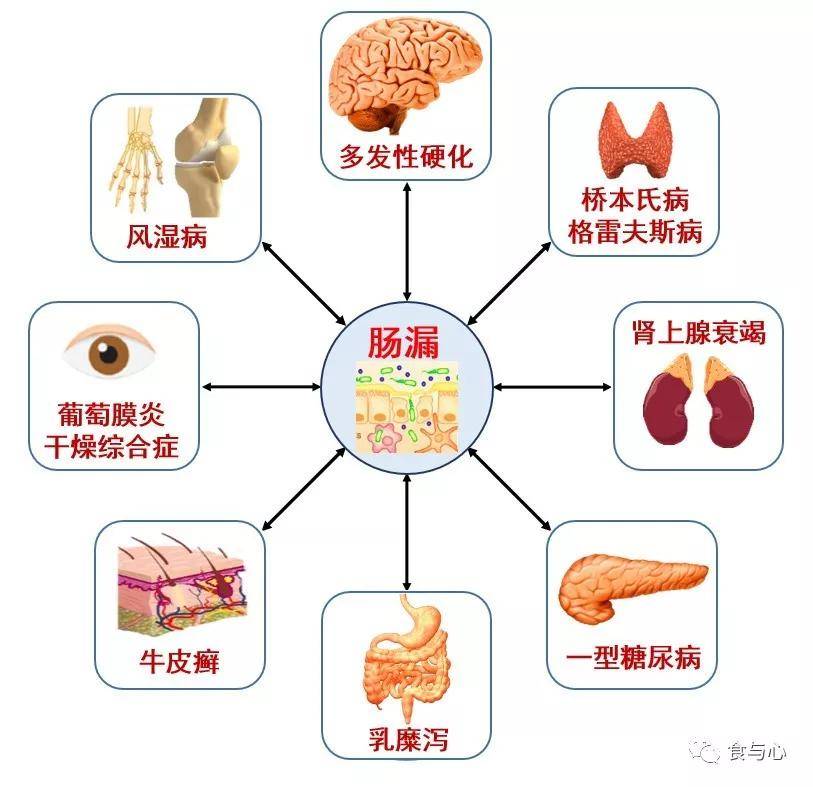 甲状腺|肠漏，你必须知道的热知识（二）