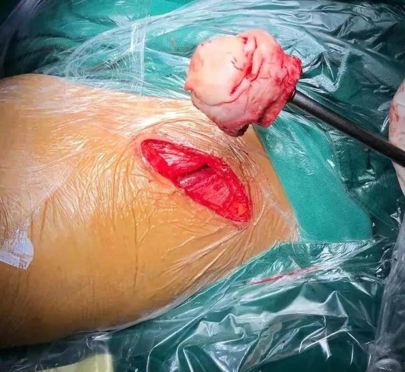 daa髋关节置换专用手术床