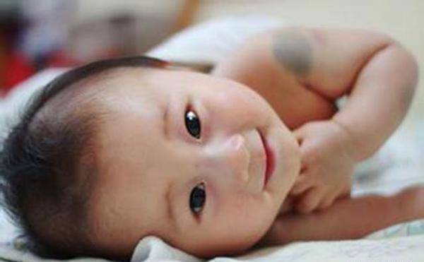 app|胎记是怎么来的？产科医生：孕期要避开3种行为，以免宝宝长胎记