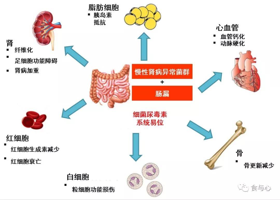 肠道|肠漏，你必须知道的热知识（三）