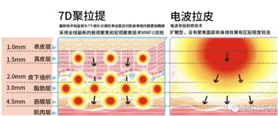 能量2021年7d聚拉提做全脸多少钱：7d聚拉提价格多少钱一次？避坑指南！