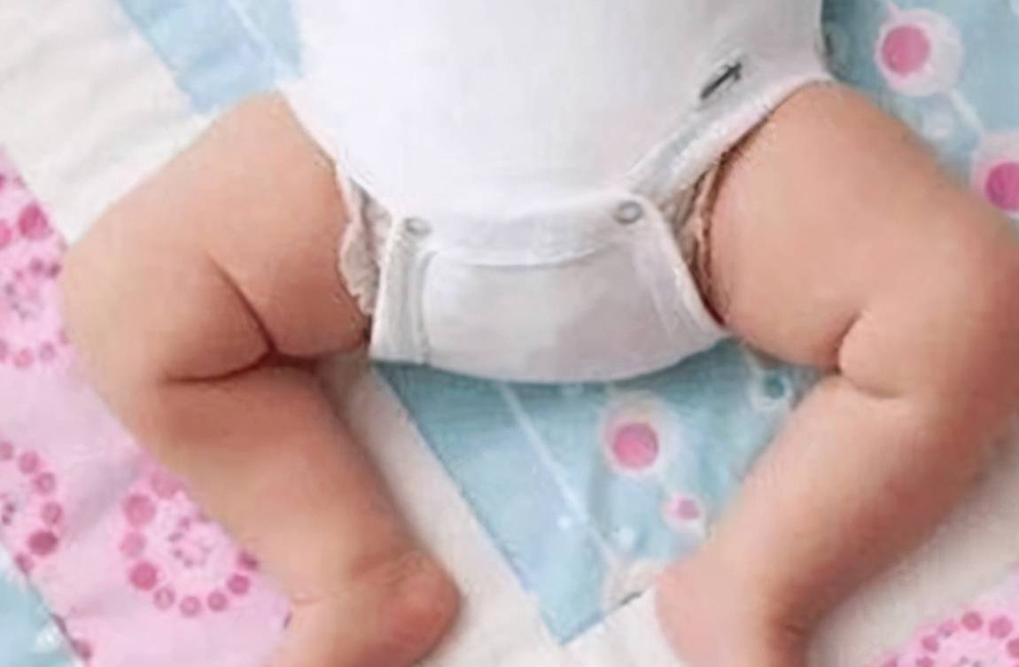 宝宝几个月会用膝盖爬正常 3f2f7e6ca3f249f1a9c9cf10cec66c73.jpeg