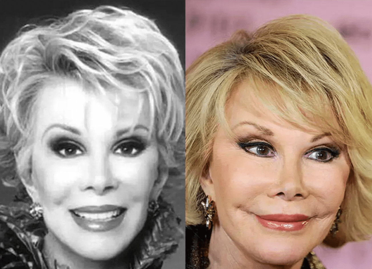 原创整容狂人乔斯林嫁豪门失败离婚分得25亿美元如今怎么样了