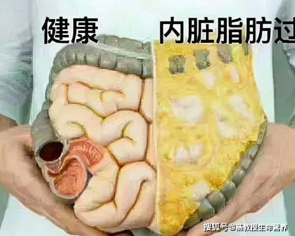 减内脏脂肪的食物排行榜_减内脏脂肪的食物