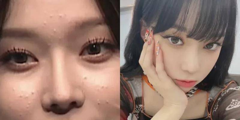 黑头她说自己的美貌主要归功于坚持不懈的皮肤管理？