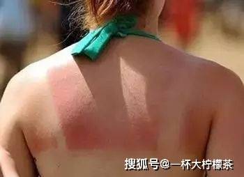 合成皮肤吹弹可破和浑身白皙光滑？不用选！谷胱甘肽能抑制黑色素沉积，自然美白