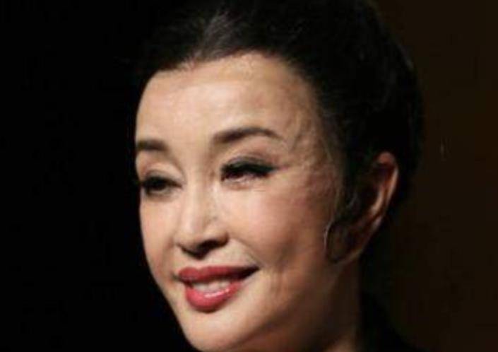 牛莉明星整容后遗症多严重？蔡明脸肿似馒头，刘晓庆面部僵硬没法细看